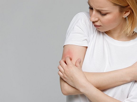 Frau mit Hautrötung am Arm